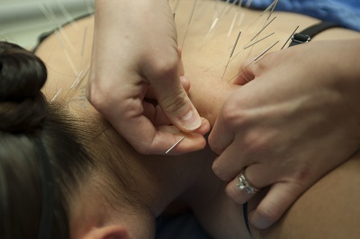 99th MDG providers receive acupuncture training