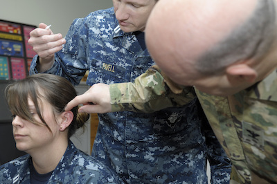 Battlefield Acupuncture Introduced at Naval Health Clinic Corpus Christi