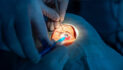 Guyana, U.S. ophthalmology teams restore vision, strengthen readiness during LAMAT 2026